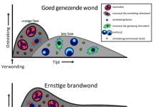 Ingewikkelde ontstekingsreactie na brandwonden in kaart gebracht Wondgenezing.