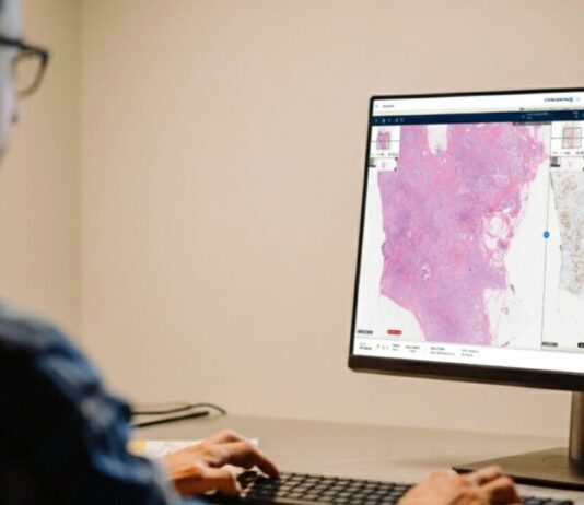 Spaarne Gasthuis op weg naar digitale pathologie